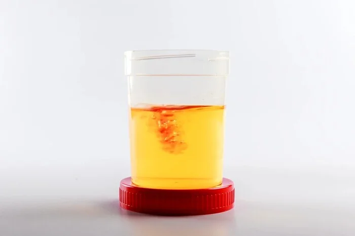 خون در ادرار زنان نشانه چیست؟ (قسمت اول)