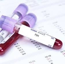 آزمایش غربالگری ناقلی (Expanded Carrier Screening) آزمایشی است که وضعیت ناقلی فرد را در رابطه با بیش از ۲۸۰ بیماری نهفته (مغلوب) بررسی می‌کند 