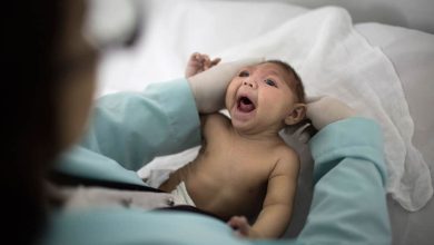 بیماری میکروسفالی