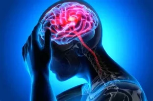 علائم سکته مغزی
